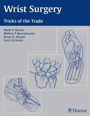 Wrist Surgery: Tricks of the Trade 1st