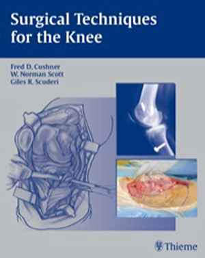 Surgical Techniques for the Knee  1st