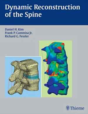 Dynamic Reconstruction of the Spine 1st