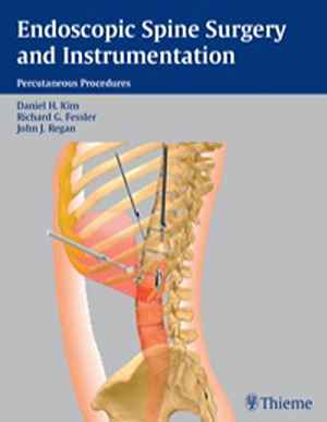 Endoscopic Spine Surgery and Instrumentation  1st