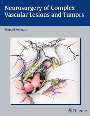 Neurosurgery of Complex Vascular Lesions and Tumors 1st