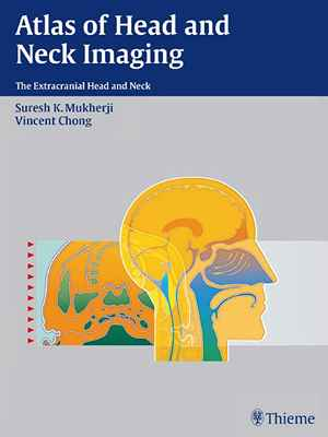 Atlas of Head and Neck Imaging: The Extracranial Head and Neck  1st