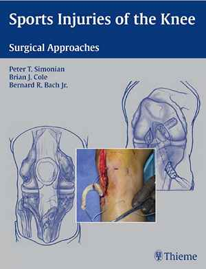 Sports Injuries of the Knee