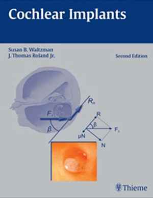Cochlear Implants  2nd