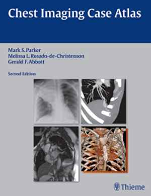 Chest Imaging Case Atlas  2nd