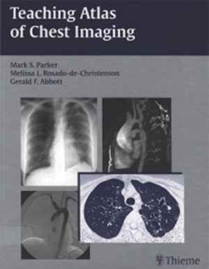 Teaching Atlas of Chest Imaging 1st