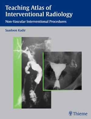 Teaching Atlas of Interventional Radiology: Non-Vascular Interventional Procedures  1st
