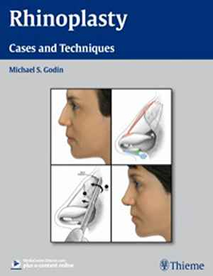 Rhinoplasty: Cases and Techniques  1st