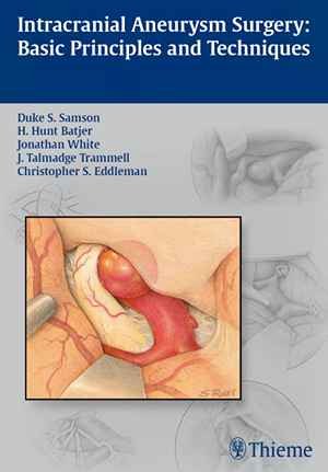 Intracranial Aneurysm Surgery: Basic Principles and Techniques 1st