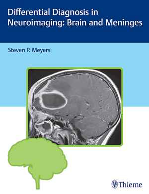 Differential Diagnosis in Neuroimaging: Brain and Meninges  1st