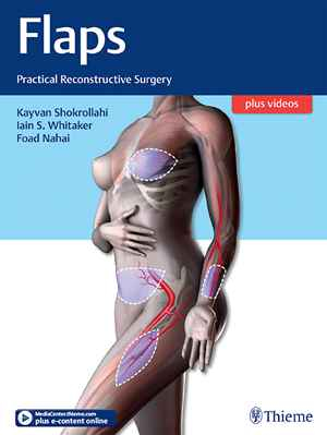 Flaps: Practical Reconstructive Surgery  1st