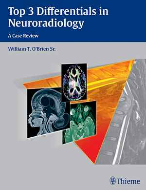 Top 3 Differentials in Neuroradiology  1st