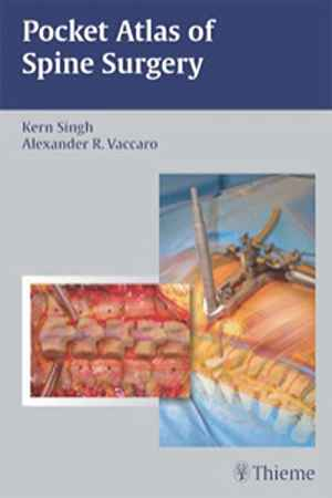 Pocket Atlas of Spine Surgery  1st