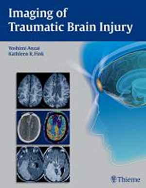 Imaging of Traumatic Brain Injury 1st