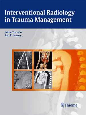 Interventional Radiology in Trauma Management 1st