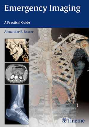 Emergency Imaging: A Practical Guide 1st