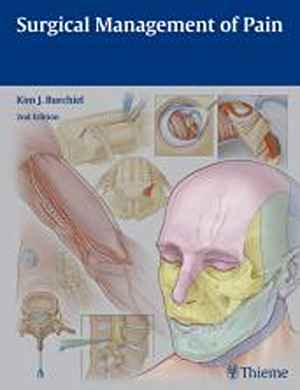 Surgical Management of Pain  2nd