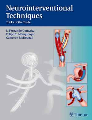Neurointerventional Techniques: Tricks of the Trade 1st