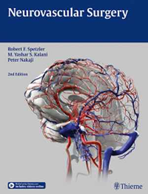Neurovascular Surgery  2nd