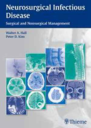 Neurosurgical Infectious Disease: Surgical and Nonsurgical Management  1st