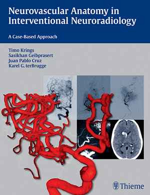 Neurovascular Anatomy in Interventional Neuroradiology: A Case-Based Approach  1st