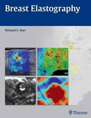 Breast Elastography  1st