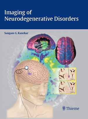 Imaging of Neurodegenerative Disorders  1st