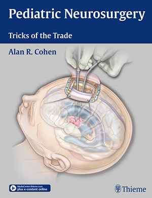 Pediatric Neurosurgery: Tricks of the Trade  1st