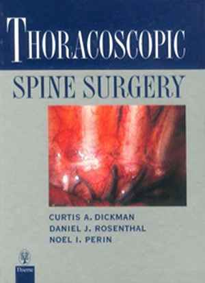 Thoracoscopic Spine Surgery  1st