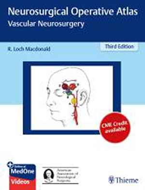 Neurosurgical Operative Atlas: Vascular Neurosurgery  3rd
