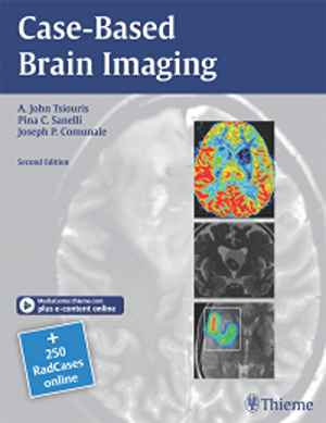 Case-Based Brain Imaging  2nd