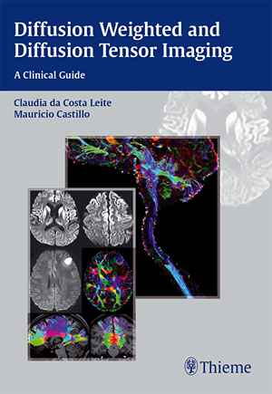 Diffusion Weighted and Diffusion Tensor Imaging