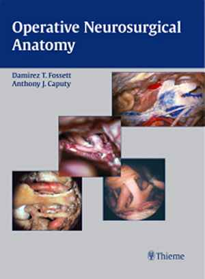 Operative Neurosurgical Anatomy 1st