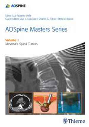 AOSpine Masters Series, Volume 1: Metastatic Spinal Tumors  1st