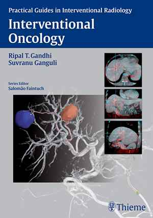 Interventional Oncology 1st