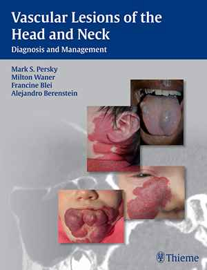 Vascular Lesions of the Head and Neck: Diagnosis and Management  1st