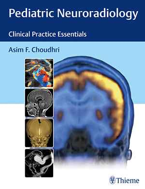 Pediatric Neuroradiology: Clinical Practice Essentials  1st
