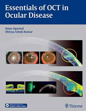 Essentials of OCT in Ocular Disease  1st