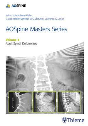 AOSpine Masters Series, Volume 4: Adult Spinal Deformities 1st