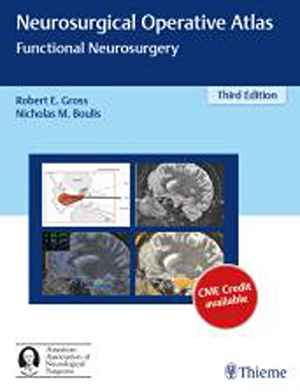 Neurosurgical Operative Atlas: Functional Neurosurgery 3rd