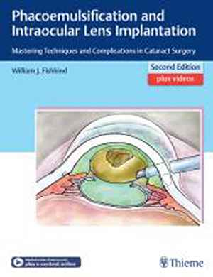 Phacoemulsification and Intraocular Lens Implantation: Mastering Techniques and Complications in Cataract Surgery 2nd