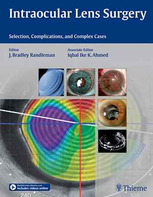 Intraocular Lens Surgery: Selection, Complications, and Complex Cases 1st