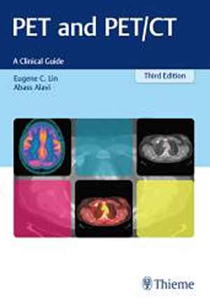 PET and PET/CT: A Clinical Guide 3rd