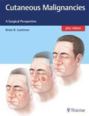 Cutaneous Malignancies: A Surgical Perspective 1st