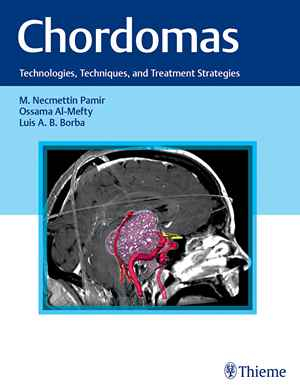 Chordomas: Technologies, Techniques, and Treatment Strategies 1st
