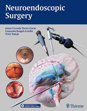 Neuroendoscopic Surgery 1st