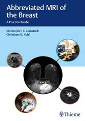 Abbreviated MRI of the Breast: A Practical Guide  1st