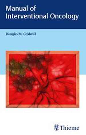 Manual of Interventional Oncology  1st