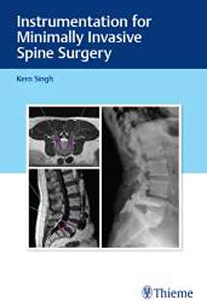 Instrumentation for Minimally Invasive Spine Surgery 1st