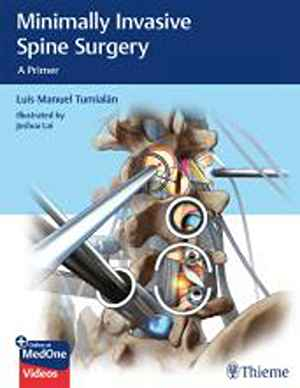 Minimally Invasive Spine Surgery: A Primer  1st